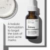 imageThe Ordinary Aloe 2  NAG 2 Solution Soothes Skin and Targets PostAcne Marks 1 Fl Oz