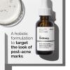 imageThe Ordinary Sensitive Skin Collection Skin Care BundleBlemishProne Skin Glucoside Foaming Cleanser Aloe 2  NAG 2 Solution Niacinamide 10  Zinc 1 Natural Moisturizing FactorsBeta Glucan