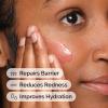 imageThe Ordinary Soothing ampamp Barrier Support Serum RednessReducing ampamp Hydrating Solution for Skin Barrier Recovery1 Fl Oz Pack of 2