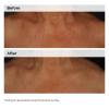 image:imageThe Ordinary Niacinamide 5 Face and Body Emulsion Dark Spot amp Skin Tone Corrector 34 Fl Oz