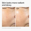 image:imageThe Ordinary Rice Lipids  Ectoin Microemulsion Moisturizer for Dry Skin Soothing Hydration Barrier Repair Reduced Redness4 Fl Oz Pack of 1